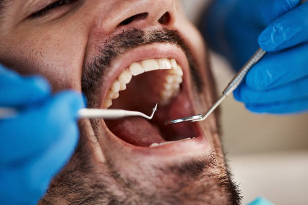 Best Emergency Treatment for Dental Infections or Abscesses in Palatine, IL