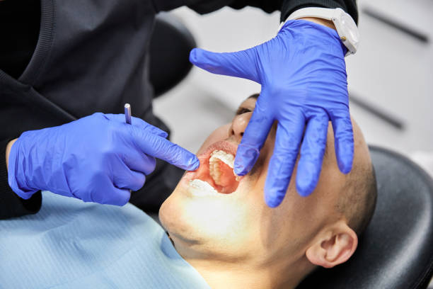 Best Emergency Dental Care for Broken or Chipped Teeth in Palatine, IL
